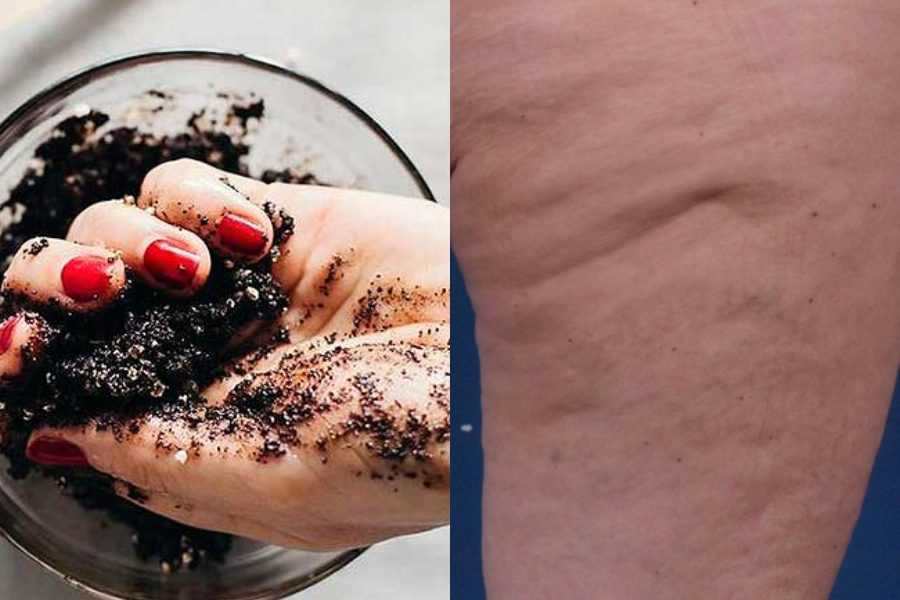 Κατακάθι καφέ: Δείτε εδώ τις απόλυτες χρήσεις του