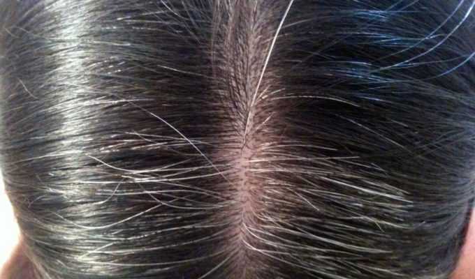 Χρησιμοποιησε αυτό το μείγμα και πές αντίο στις λευκές τρίχες