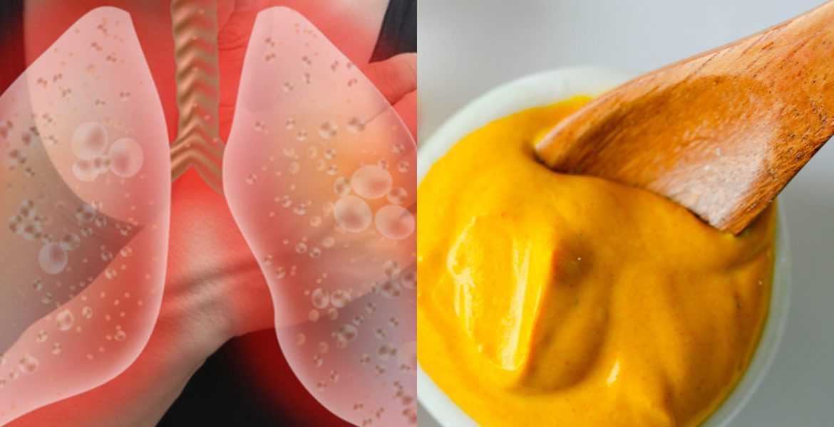 Φλέματα: Φυσικά σπιτικά γιατροσόφια για να τα εξαφανίσετε